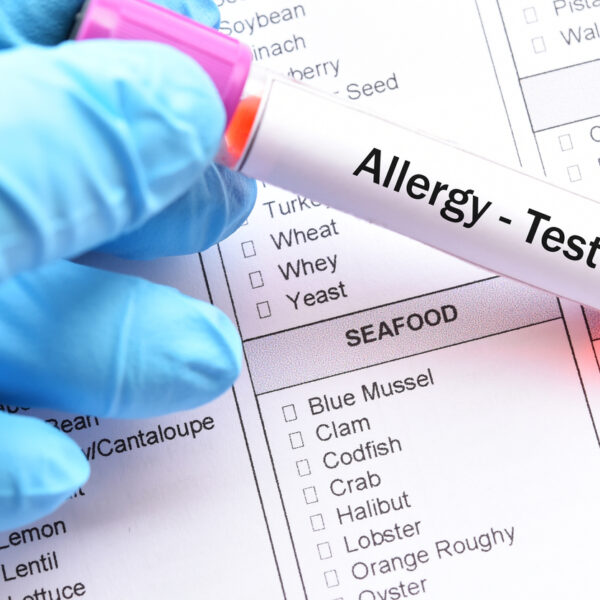 Food allergy test